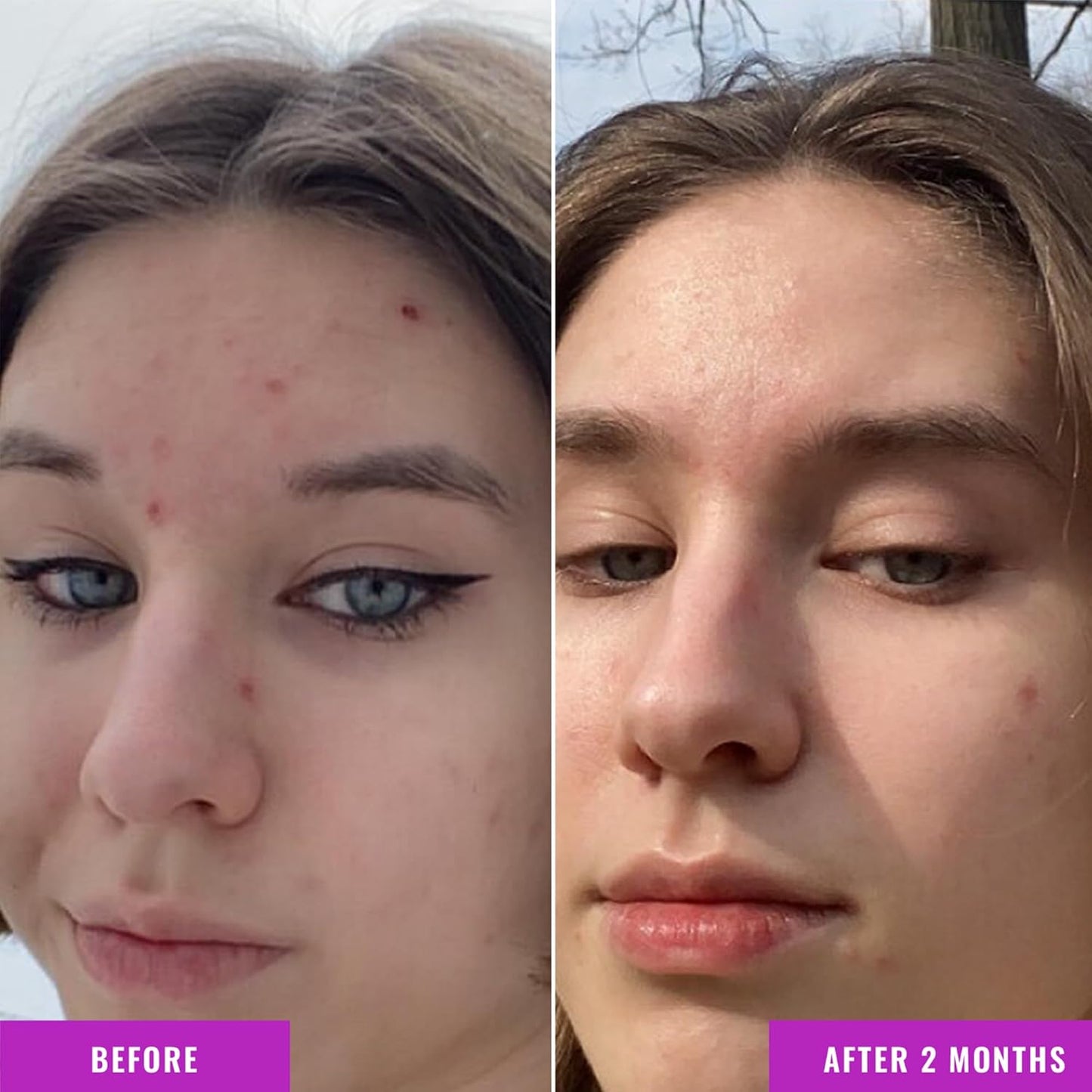 Good Molecules Niacinamide Serum - 10% Niacinamide