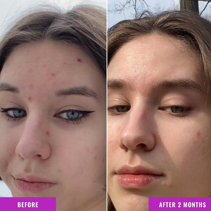 Good Molecules Niacinamide Serum - 10% Niacinamide