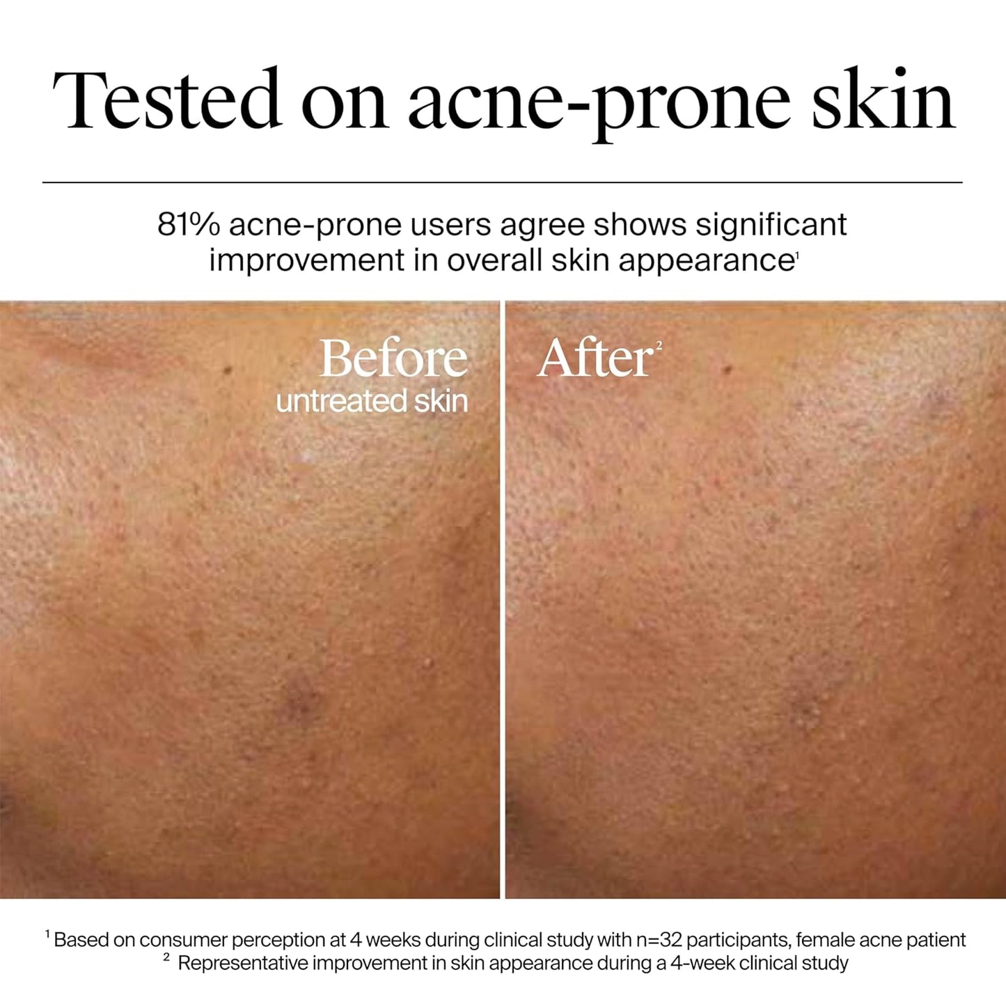 Neutrogena Hydro Boost Hyalouronic Acid Aqua-Gel Cream