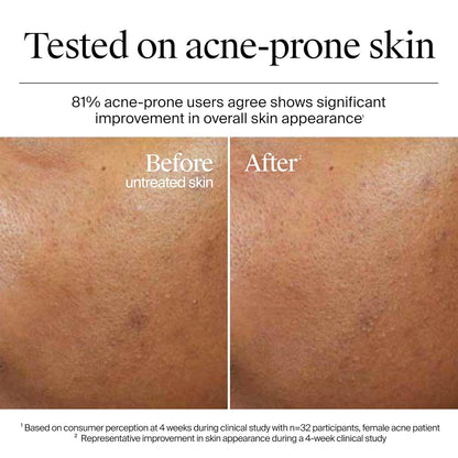 Neutrogena Hydro Boost Hyalouronic Acid Aqua-Gel Cream